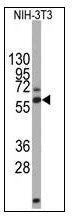 NBP1-50580 - DPYSL2 / CRMP2