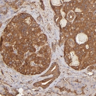 NBP1-85448 - DPYSL2 / CRMP2