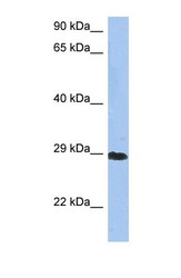 NBP1-52907 - Beta-crystallin A3