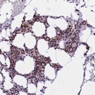 NBP1-91812 - Beta-crystallin A2
