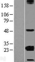 NBL1-09498 - CRYBA2 Lysate