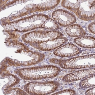NBP1-91813 - Beta-crystallin B3