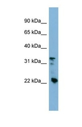 NBP1-55088 - Beta-crystallin B3