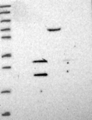 NBP1-91813 - Beta-crystallin B3