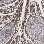 NBP1-89533 - Zeta-crystallin