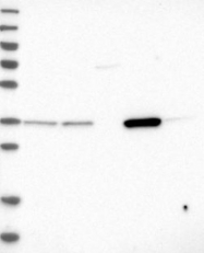 NBP1-89533 - Zeta-crystallin