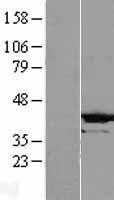 NBL1-09504 - CRYZL1 Lysate