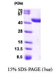 NBP1-44477 - Zeta-crystallin homolog