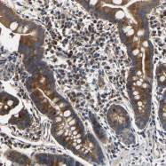 NBP1-85341 - UNR protein / CSDE1