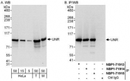 NBP1-71915 - UNR protein / CSDE1