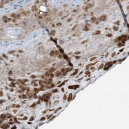 NBP1-88086 - CSGLCAT