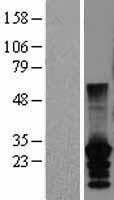 NBL1-09559 - CT45A2 Lysate