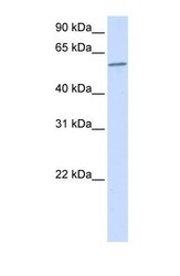 NBP1-57844 - PPP3CA / Calcineurin A
