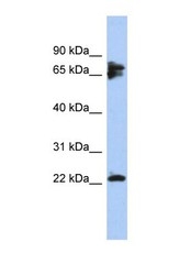 NBP1-56816 - PPP3R1 / Calcineurin B