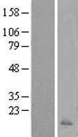 NBL1-08643 - Calcitonin Lysate