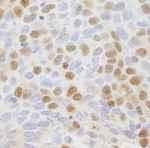 NB100-79803 - XPO2 / Exportin-2