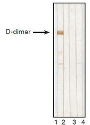 NB110-8374 - D-Dimer