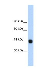 NBP1-57255 - DAZAP1