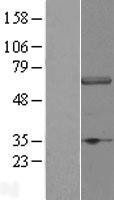 NBL1-17798 - DCAF11 Lysate