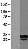 NBL1-09759 - DCUN1D5 Lysate