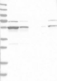 NBP1-83248 - DDX6