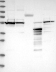 NBP1-83249 - DDX6