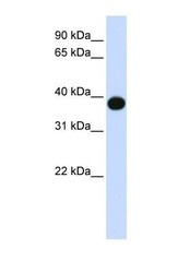 NBP1-59941 - DEGS1