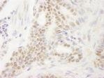 NB100-61057 - DEK