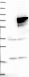 NBP1-84742 - DENND1A