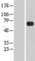NBL1-09827 - DENND1A Lysate