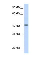 NBP1-69231 - DENND1B