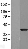 NBL1-08314 - DENND1B Lysate