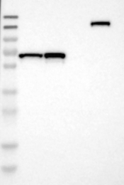 NBP1-90787 - DENND4C