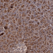 NBP1-88360 - DEPDC1B