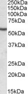 NBP1-45143 - Desmin