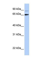 NBP1-57261 - DGCR8