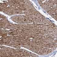 NBP1-85227 - DAG kinase iota