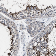 NBP1-85315 - DAG kinase epsilon