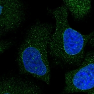 NBP1-85228 - DAG kinase eta / DGKH