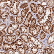 NBP1-85228 - DAG kinase eta / DGKH