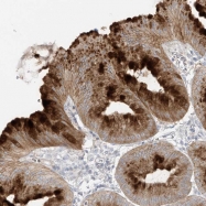 NBP1-85317 - DAG kinase theta