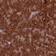 NBP1-80740 - 7-DHC reductase