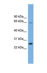 NBP1-55510 - DHFRL1 / DHFRP4