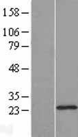 NBL1-09861 - DHFRL1 Lysate