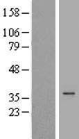 NBL1-09865 - DHRS1 Lysate