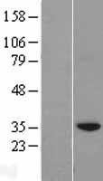 NBL1-09868 - DHRS3 Lysate