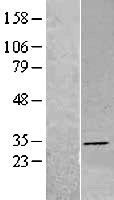 NBL1-09869 - DHRS4 Lysate