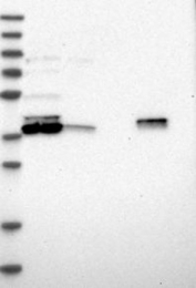 NBP1-80842 - DHRS7A