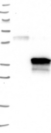 NBP1-85649 - DHRS7B