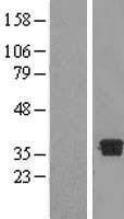 NBL1-09872 - DHRS7B Lysate